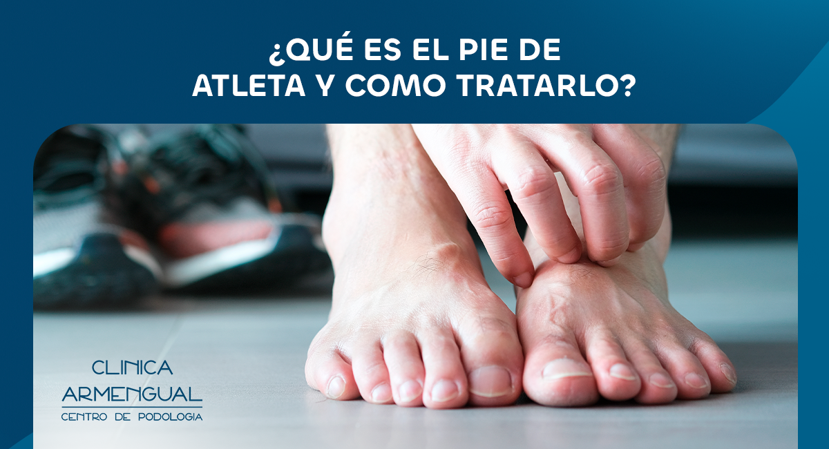 Pie de atleta clinica armengual